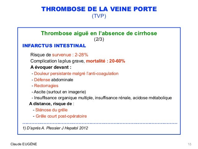 thrombose aigue thrombose aigue